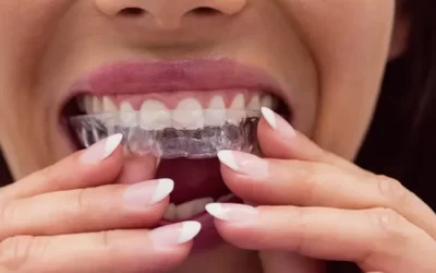 Invisalign Columbus: Clear Aligner Therapy for Discreet Orthodontic Correction